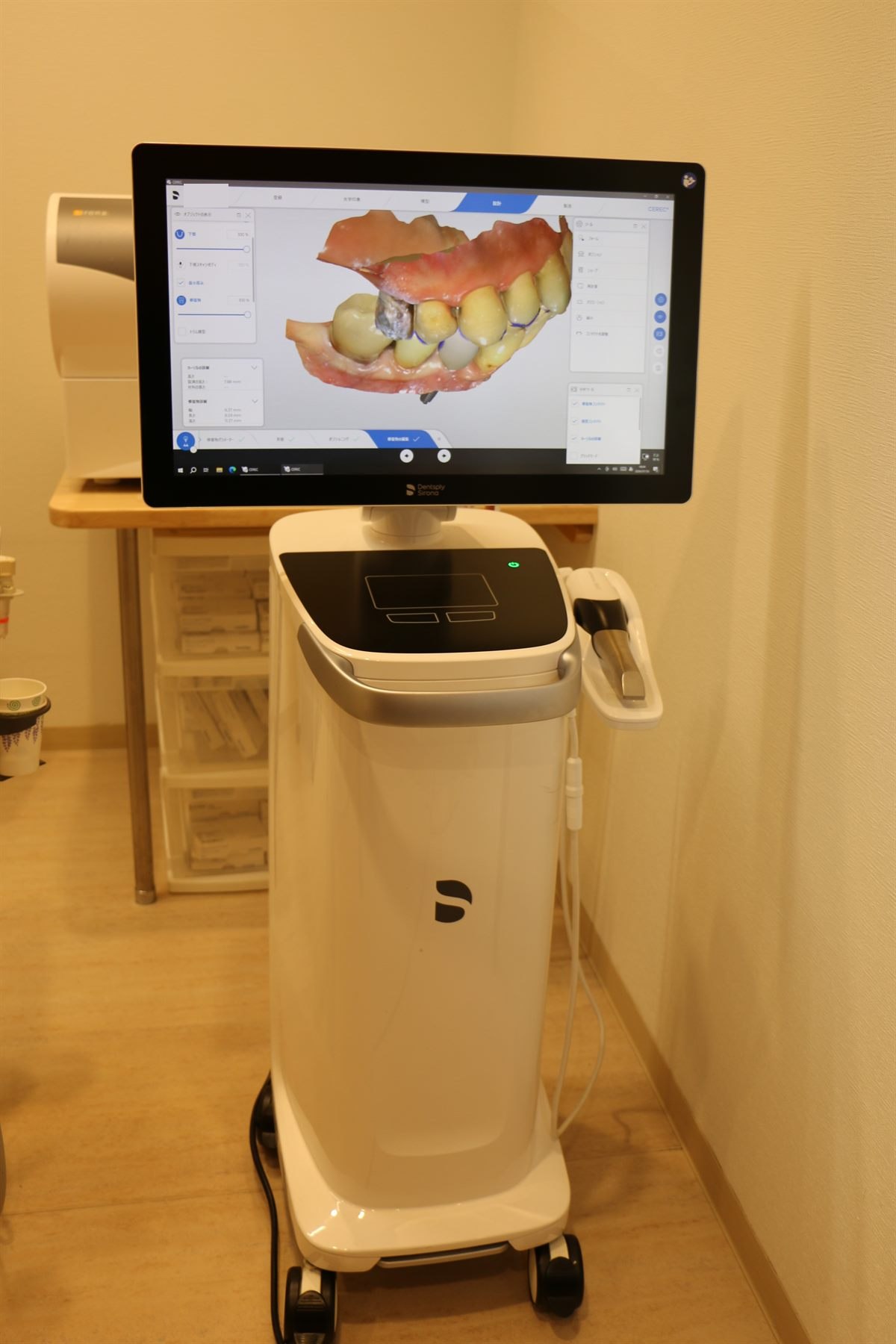当院の口腔内スキャナー。画面に歯列のスキャンデータが表示されている