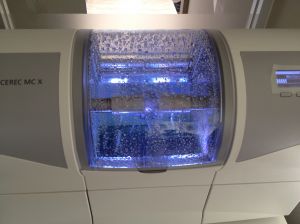 セレックで作製した白いセラミックの被せ物（クラウン）。金属を使わない自然な白さの修復物