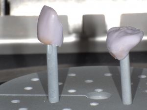 専用の電気炉でイーマックス冠を焼成している様子