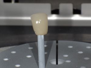 焼き上がったイーマックス冠の色を確認し、再度の色つけを行っている様子