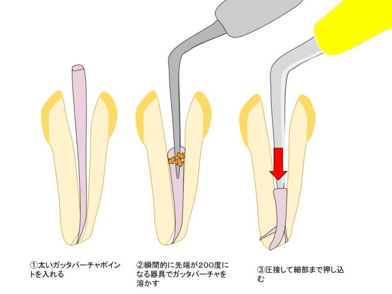 CWCT
