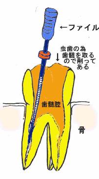 根の先を探す