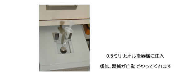 採取した口腔内の空気を、専用アプリケーターからオーラルクロマ本体に差し込んで注入しているところ