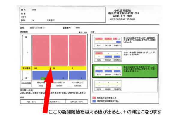 オーラルクロマの測定結果を記した判定用紙。口臭三大物質の測定値が記載されている