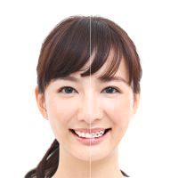 歯並びが整う前と後を左右に並べたイメージ