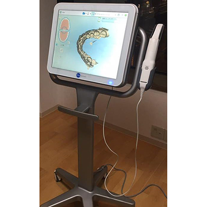 ペン型のスキャナーで口腔内の歯型をスキャンしているデジタル印象器