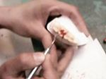 歯科技工 工程2：ロウ（ワックス）を彫刻して歯の形を作るワックスアップの様子