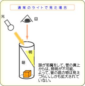 歯科用ライトでは頭の外側からしか光を当てられず、管の底のような部分が影になって暗くなる仕組みを示した図
